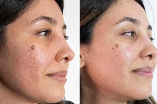 Rutina de skincare personalizada