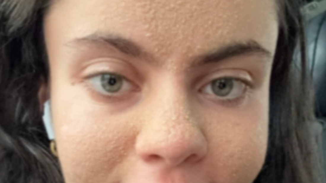 Sobre la tendencia del "anti-skincare": La opinión de una experta