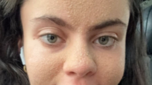 Sobre la tendencia del "anti-skincare": La opinión de una experta